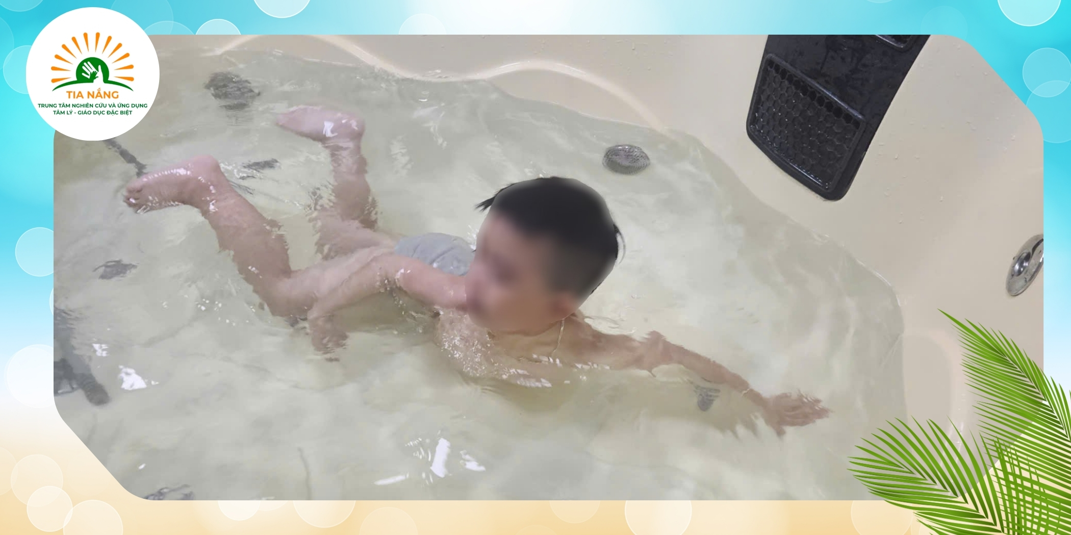 Phuong Phap Tri Lieu Dieu Hoa Cam Giac Tai Trung Tam Tia Nang Se Nhu The Nao 3